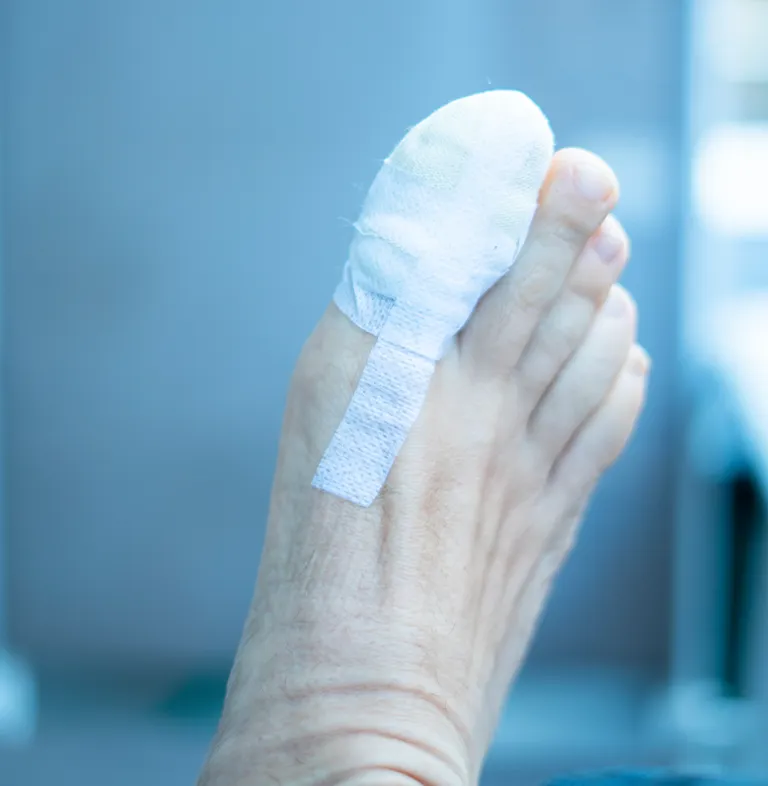 how-are-non-healing-surgical-wounds-treated