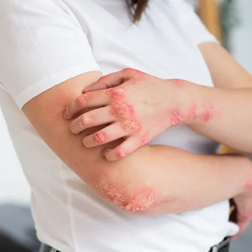 infected-wound-care-in-arkansas