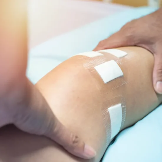 negative-pressure-wound-therapy-is-used-to-treat-many-different-wounds