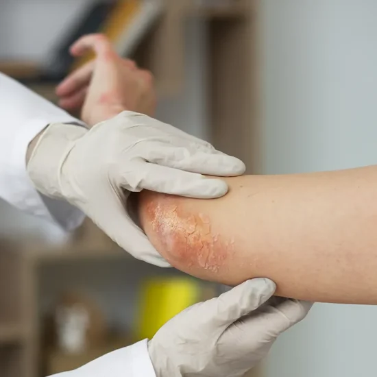 symptoms-of-infected-wounds