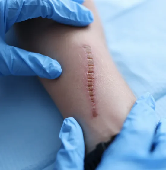 symptoms-of-surgical-wounds