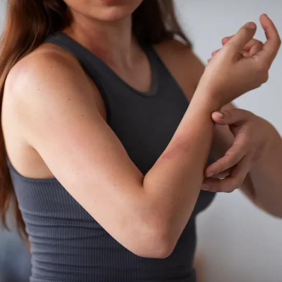 symptoms-that-require-immediate-burn-care