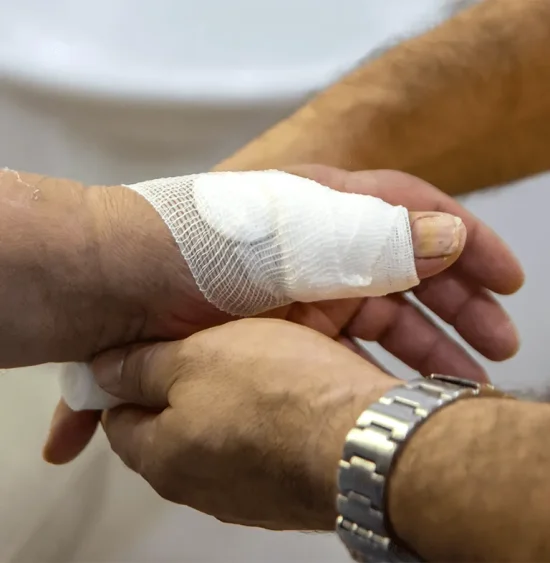 what-are-bio-engineered-skin-grafts