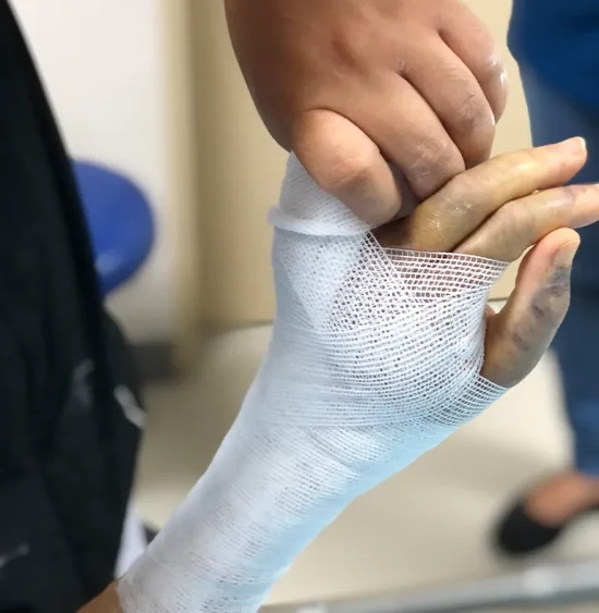 wound-debridement-treatment-in-little-rock-arkansas